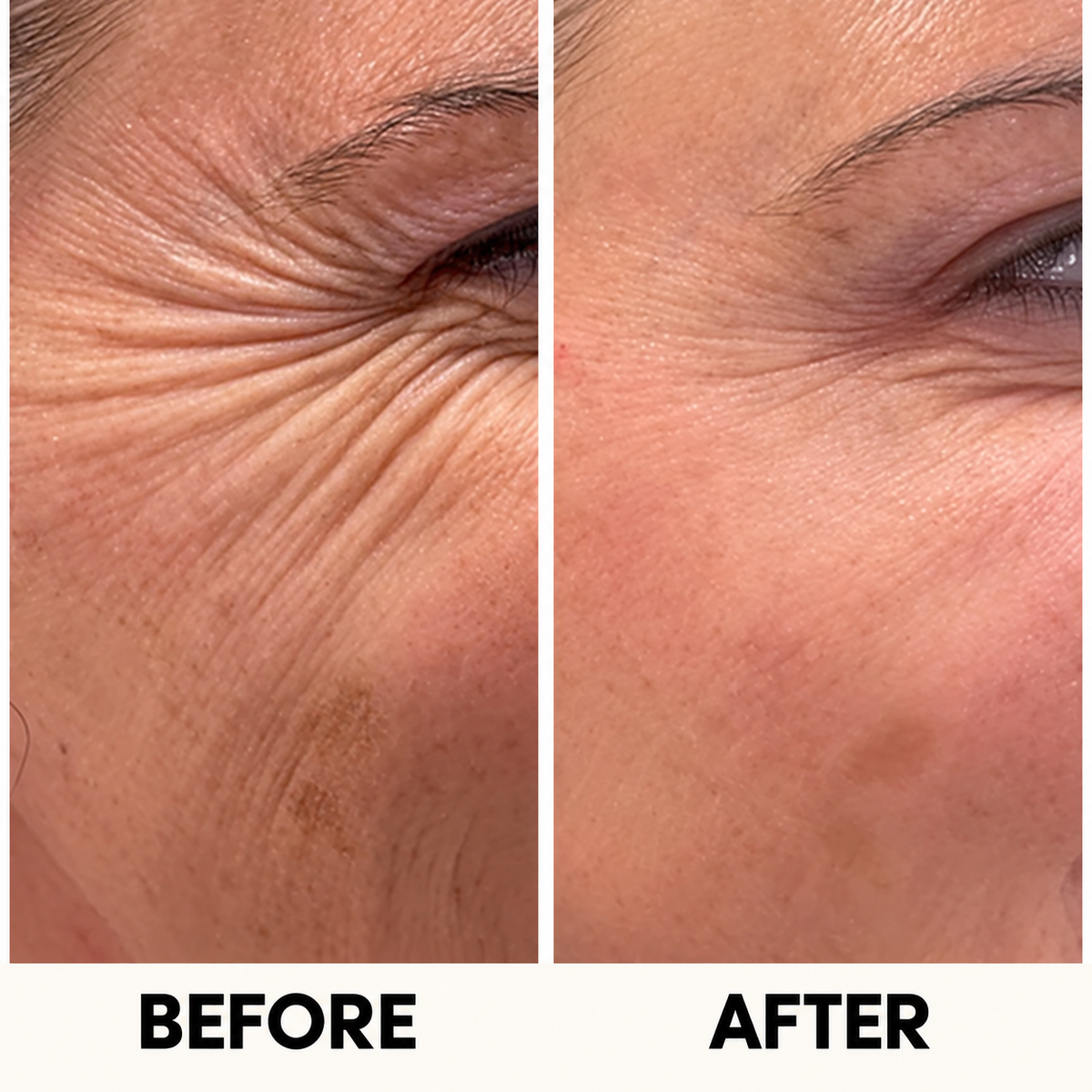 Aureva Collagen Peptide Serum WT